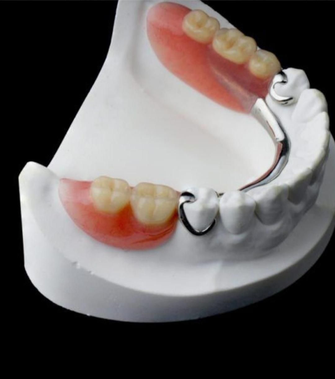 دندان مصنوعی کامل و تکی با قیمت خیریه|خدمات آرایشگری و زیبایی|زاهدان, |دیوار