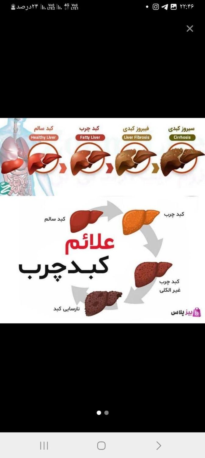 کبدچرب تو با اصلاح مزاج درمان کن|خدمات آرایشگری و زیبایی|گنبد کاووس, |دیوار