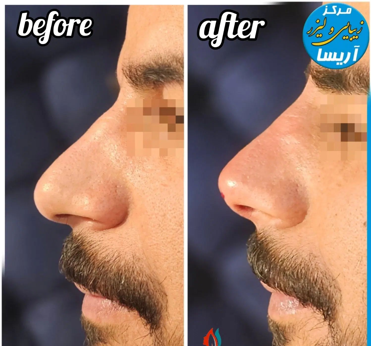 تخفیف ویژه خدمات پوست و مو به مناسبت روز  پزشک|خدمات آرایشگری و زیبایی|کرمانشاه, |دیوار