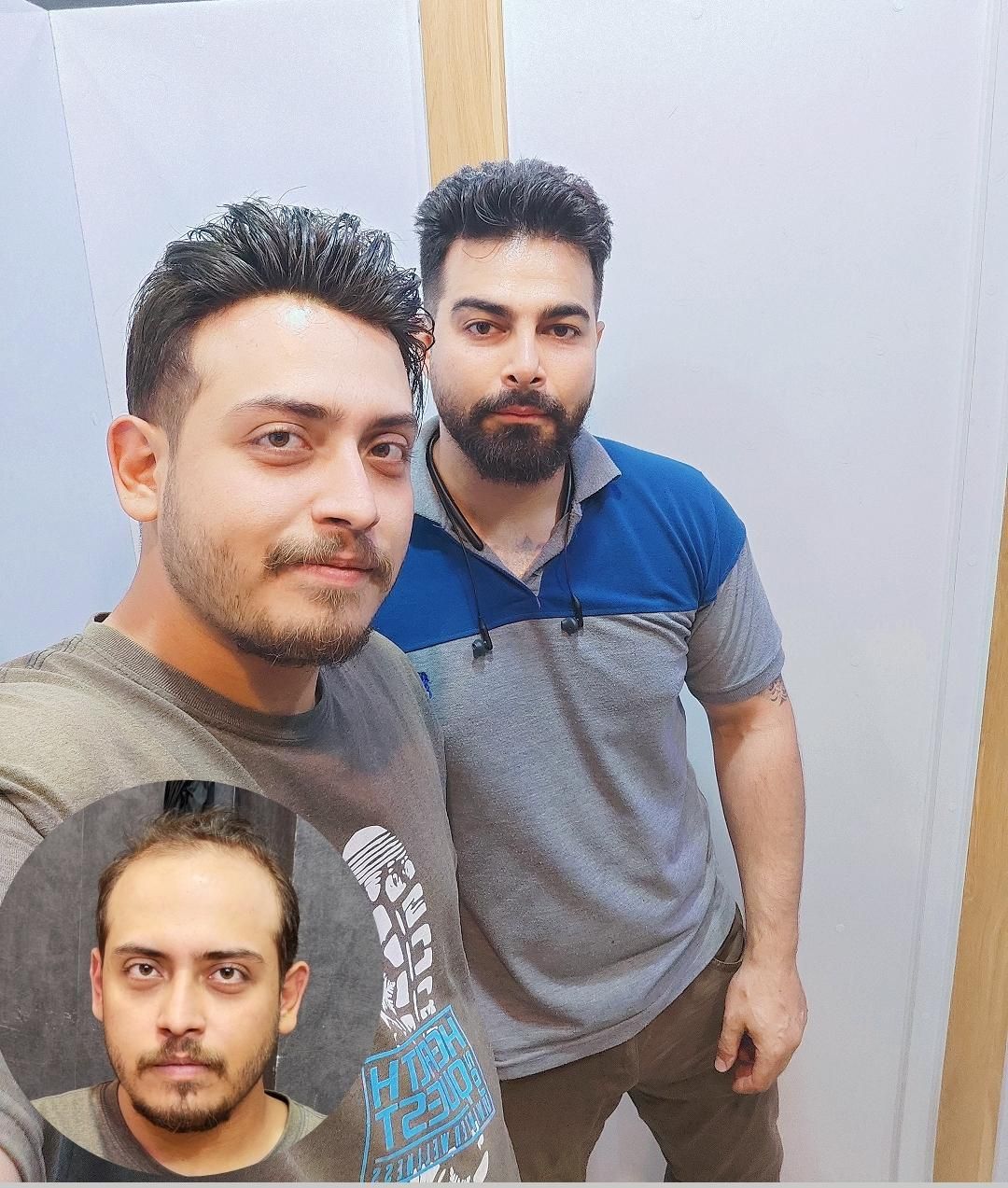 پروتز مو|آرایشی، بهداشتی، درمانی|تهران, سلسبیل جنوبی|دیوار