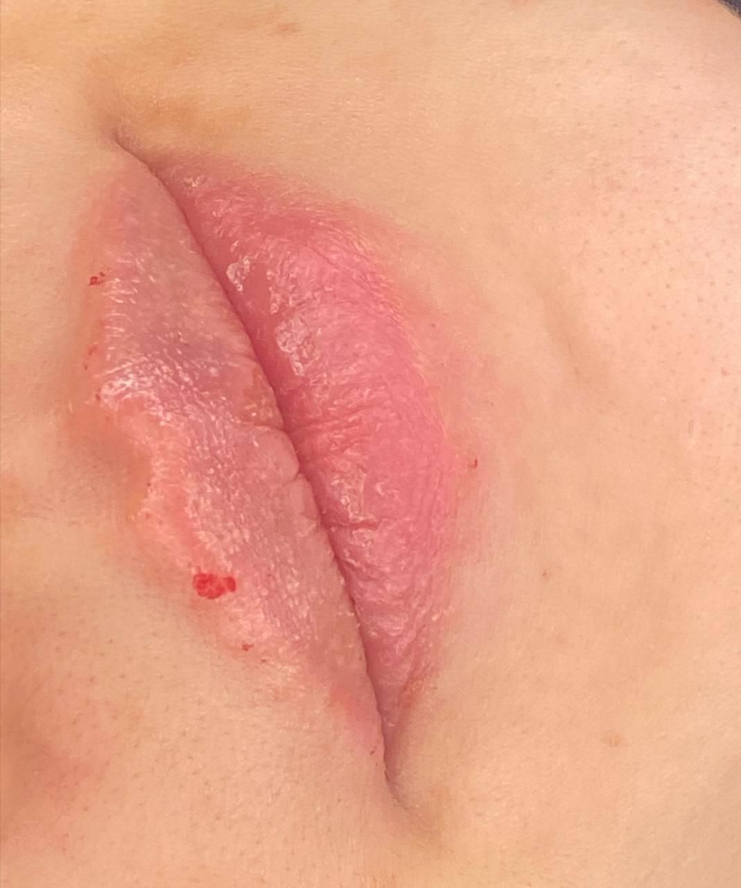 تزریق تخصصی ژل و بوتاکس رشت|خدمات آرایشگری و زیبایی|رشت, بلوار گیلان|دیوار