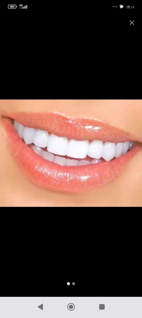 دندانپزشکی عصب کشی ،روکش،ایمپلنت،کامپوزیت|خدمات آرایشگری و زیبایی|بروجرد, |دیوار