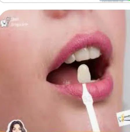 همکار دندانپزشک با مجوز|استخدام درمانی، زیبایی، بهداشتی|خرم‌آباد, |دیوار
