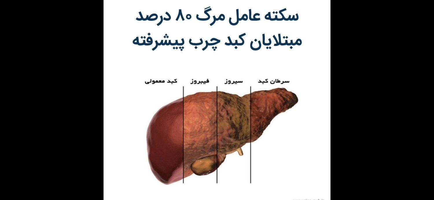 کبد چرب شما براحتی درمان می شود|خدمات آرایشگری و زیبایی|اصفهان, بیدآباد|دیوار