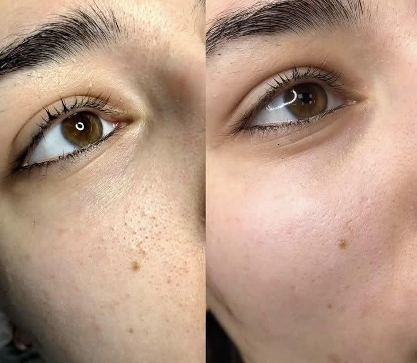 رفع تیرگی بدن و فیشیال وپاکسازی|خدمات آرایشگری و زیبایی|اردکان, |دیوار