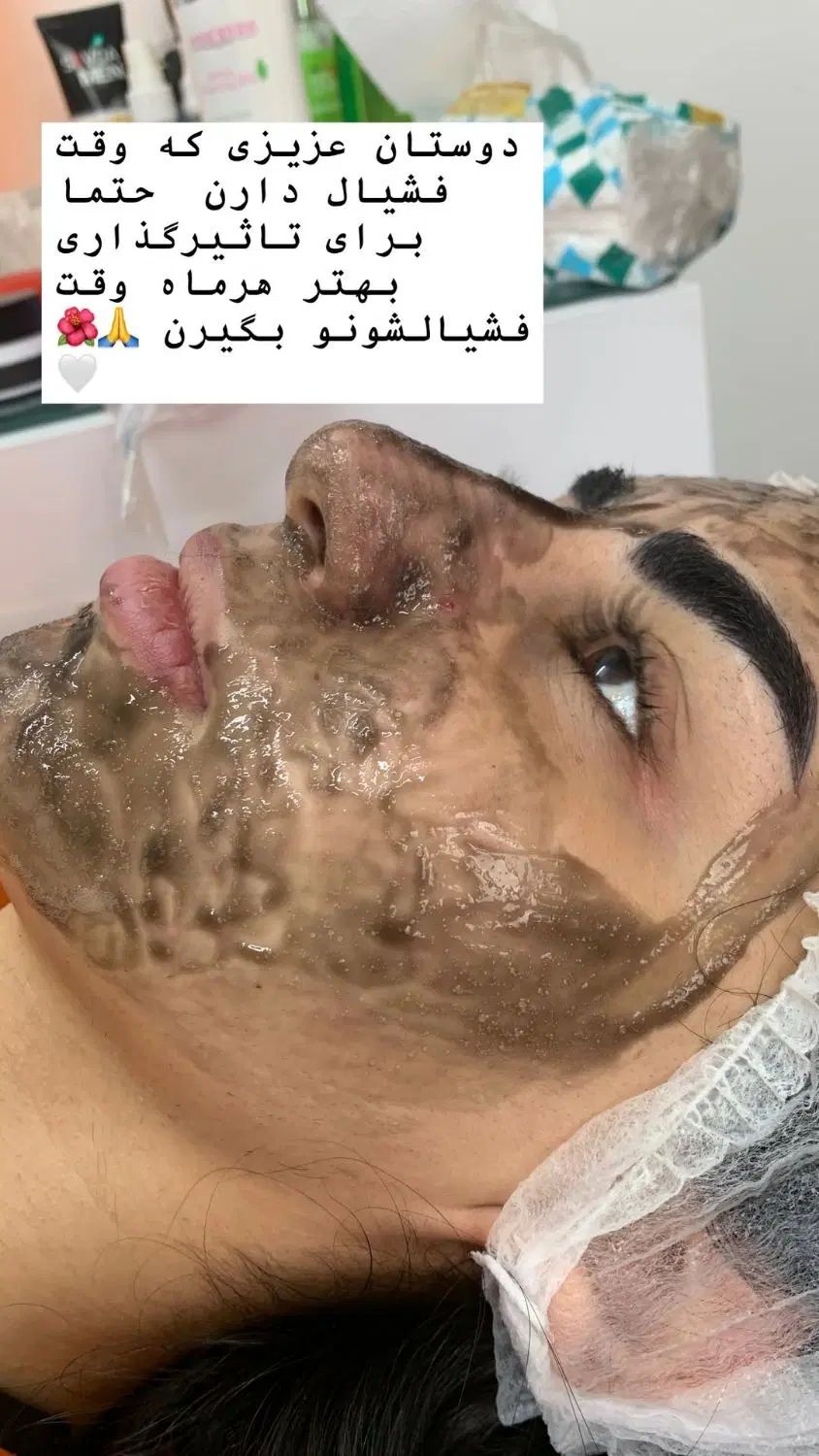 فیشیال و پاکسازی عمیق پوست|خدمات آرایشگری و زیبایی|مشهد, شهرک امام هادی (شهرک غرب)|دیوار