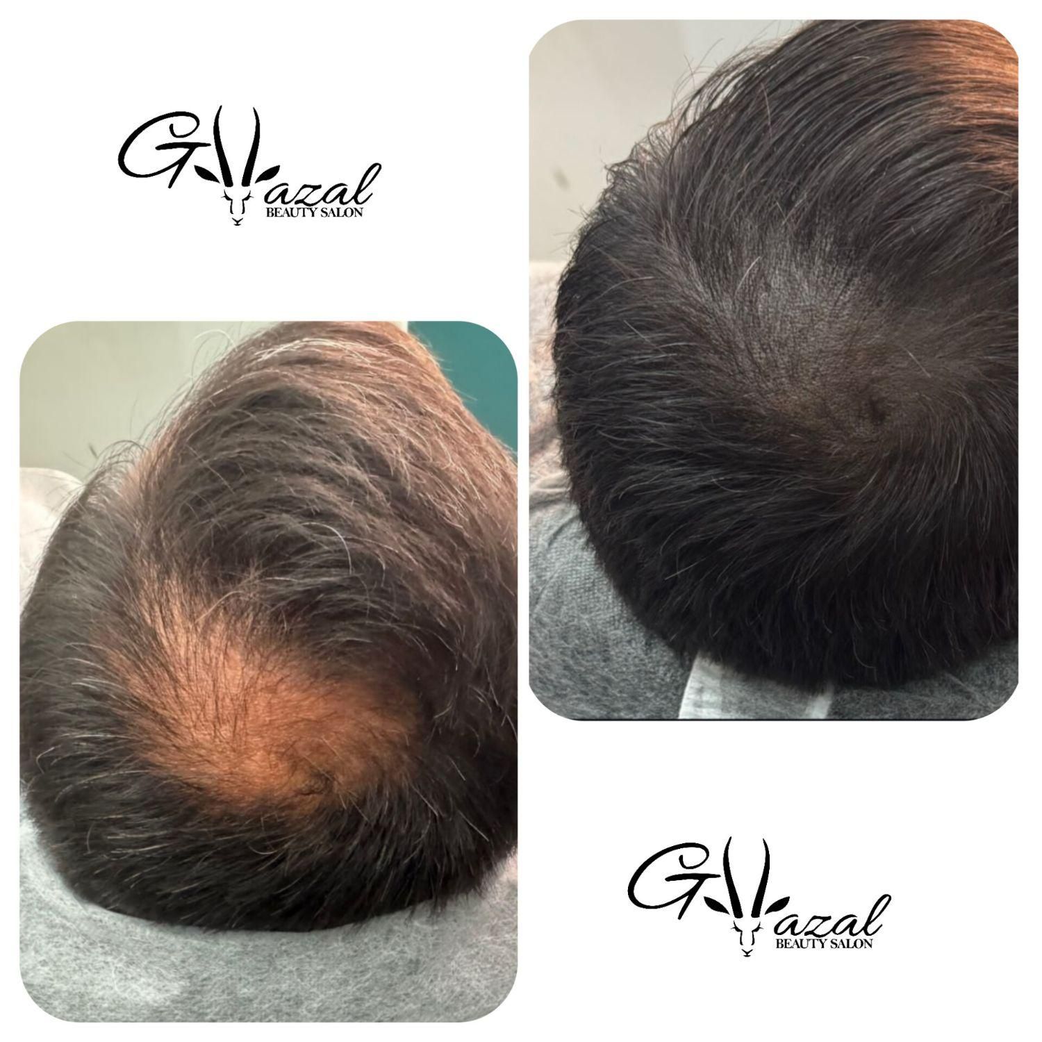میکرواسکالپ سر، میکروبلیدینگ ابرو، شیدینگ لب|خدمات آرایشگری و زیبایی|شاهین‌شهر, فردوسی|دیوار
