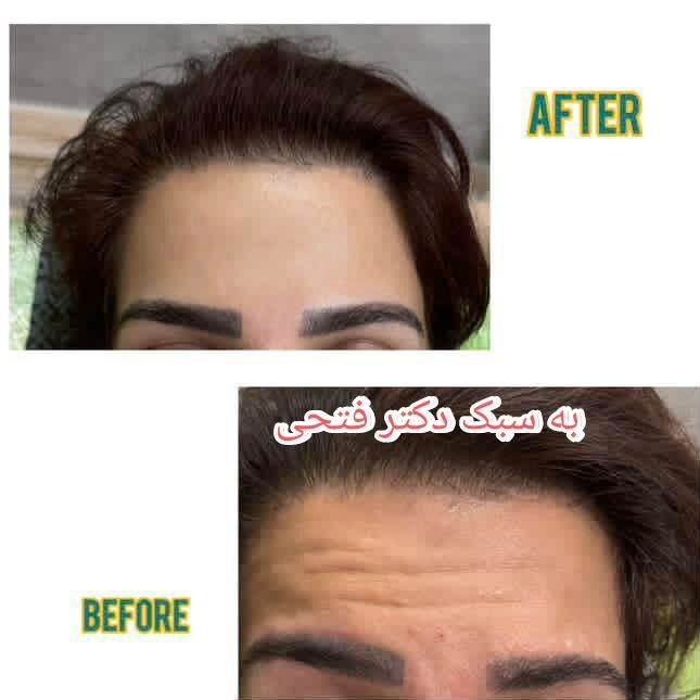 انجام کلیه خدمات زیبایی توسط پزشک در کلینیک در فسا|خدمات آرایشگری و زیبایی|فسا, |دیوار