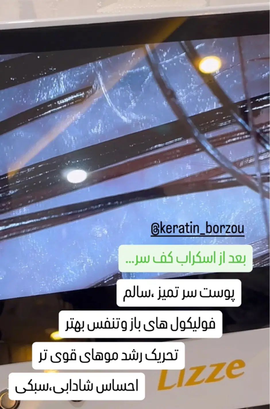اسکالپ سر،پروتئین‌تراپی،کراتین و..|خدمات آرایشگری و زیبایی|مشهد, خواجه ربیع|دیوار