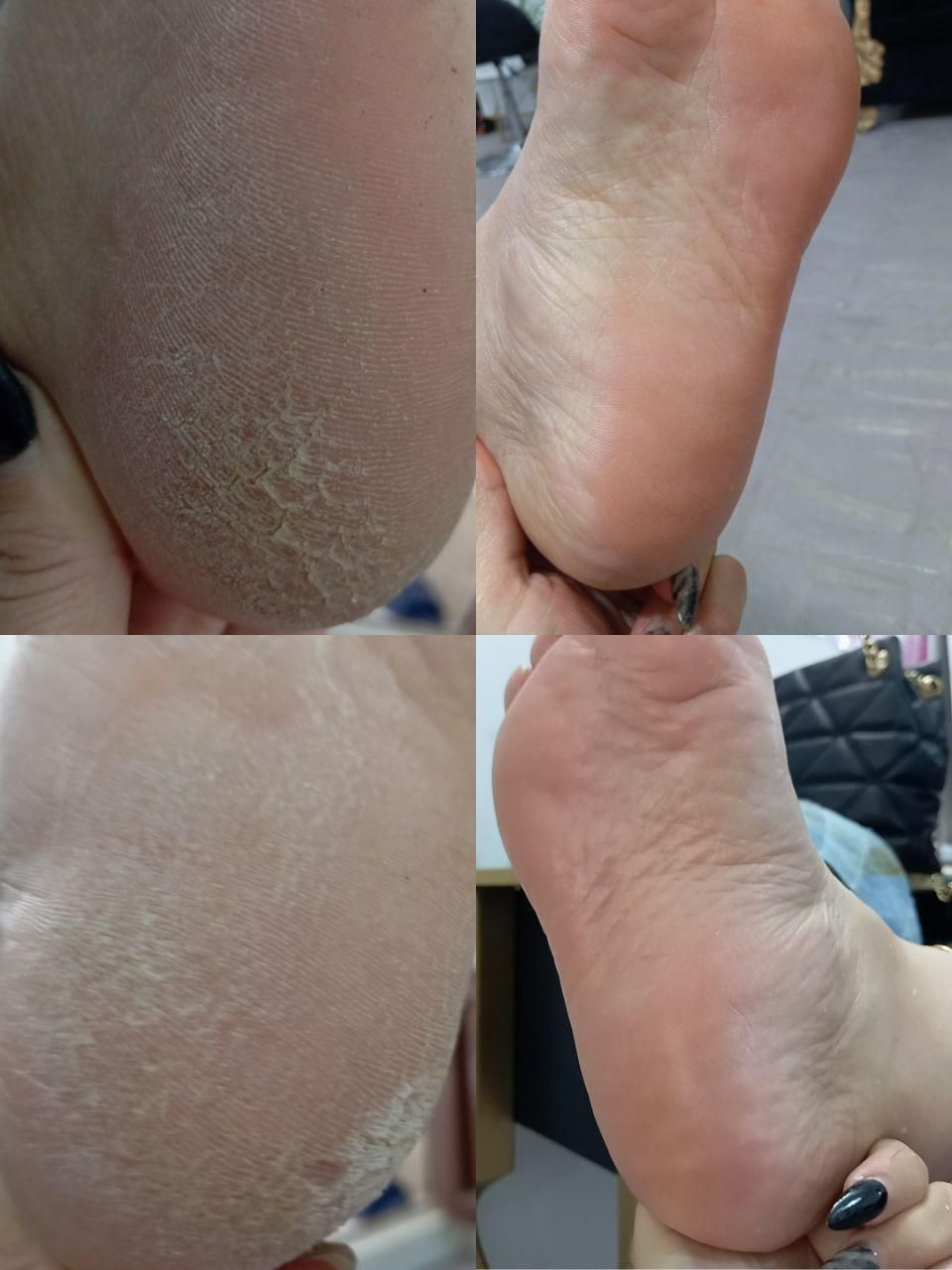 موخوره گیری کفسابی پارنگ لایت کراتین واموزش لاینها|خدمات آرایشگری و زیبایی|قم, زنبیل آباد|دیوار