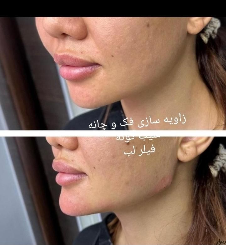 زیبایی صورت و بدن|خدمات آرایشگری و زیبایی|اهواز, نادری|دیوار