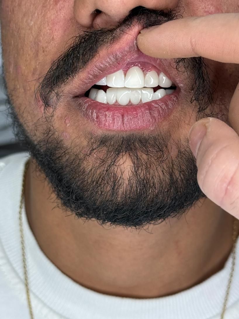 انجام خدمات جرمگیری دندان و ترمیم دندان های پوسیده|خدمات آرایشگری و زیبایی|آبادان, |دیوار