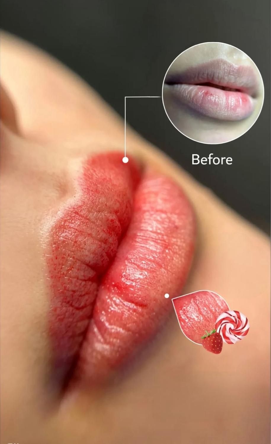 انجام خدمات شیدینگ لب / مدل خدمات لب / ساکورالیپس|خدمات آرایشگری و زیبایی|چالوس, |دیوار