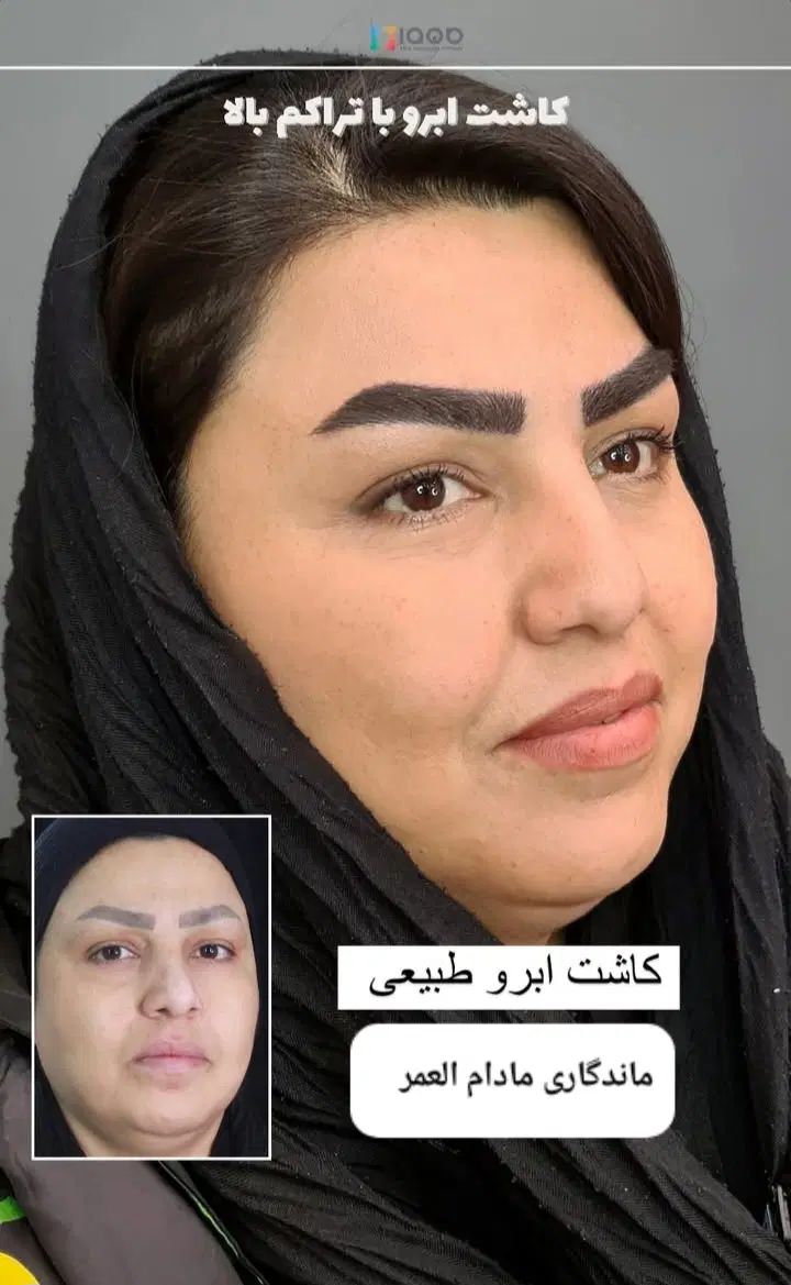 کاشت مووابروباتراکم بالا /طبیعی /اقساطی وتضمینی|خدمات آرایشگری و زیبایی|تهران, سعادت‌آباد|دیوار