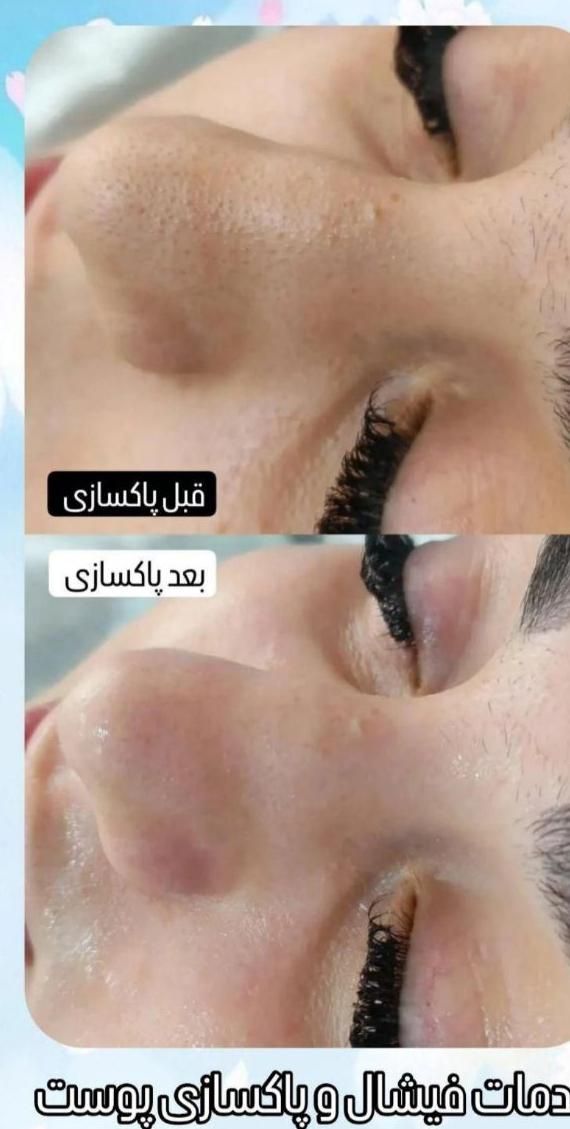مدل فیشیال ویژه با یکبار فیشیال تغییر رااحساس کنید|خدمات آرایشگری و زیبایی|کرج, گلشهر|دیوار