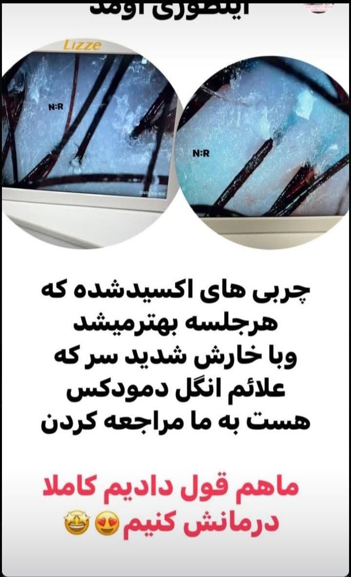 آموزش و خدمات اسکراپ اسکالپ مو سر  فقط ۶۰۰ تخصصی|خدمات آرایشگری و زیبایی|مشهد, کوثر|دیوار