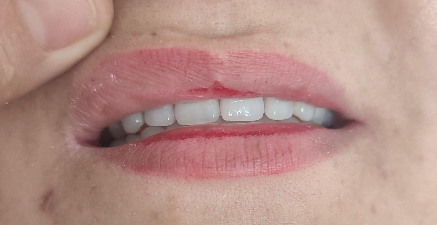 دندانسازی بانو دنت.با چک|خدمات آرایشگری و زیبایی|تربت‌حیدریه, داروپخش|دیوار