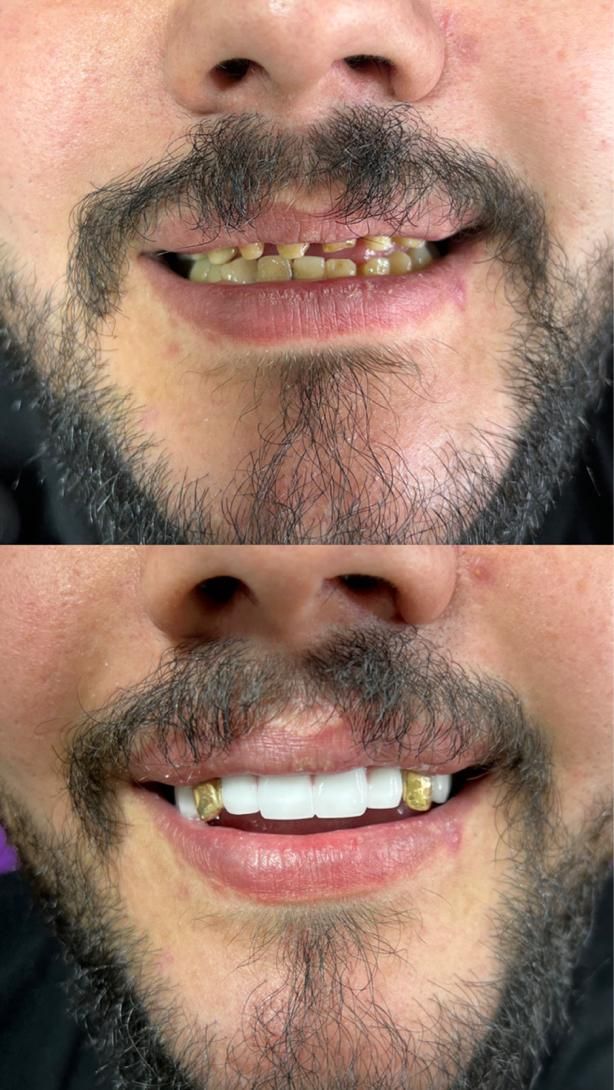 دندانپزشکی سپید|خدمات آرایشگری و زیبایی|تبریز, |دیوار