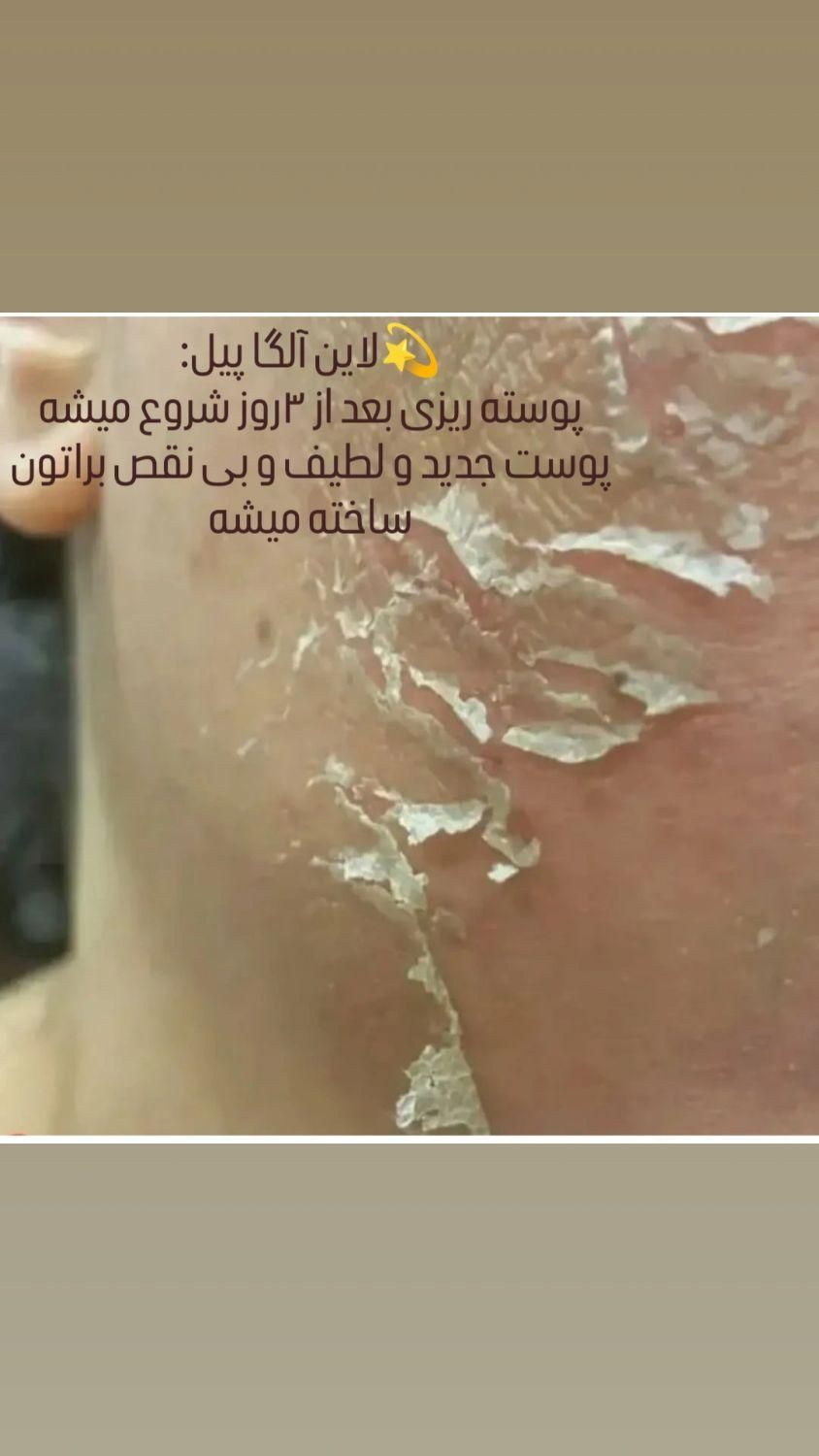 آلگاپیل،فیشال (خانمها و آقایان)|خدمات آرایشگری و زیبایی|یاسوج, |دیوار