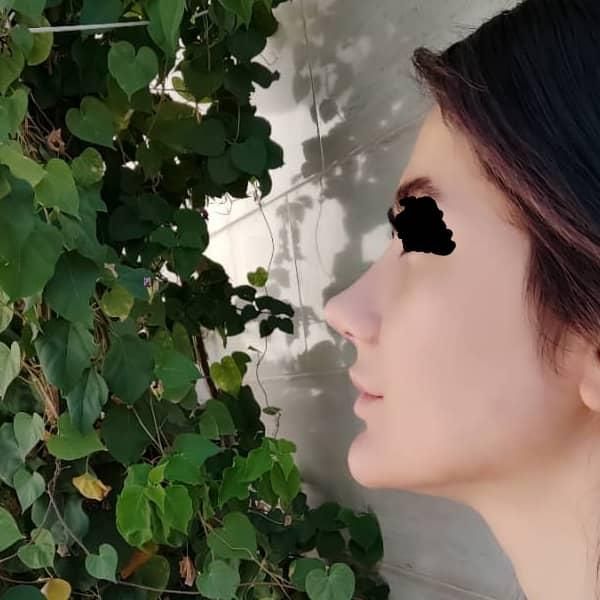 جراحی بینی شیراز /بلفاروپلاستی/ نوبت گیری /وام|خدمات آرایشگری و زیبایی|مرودشت, تامین اجتماعی‎|دیوار