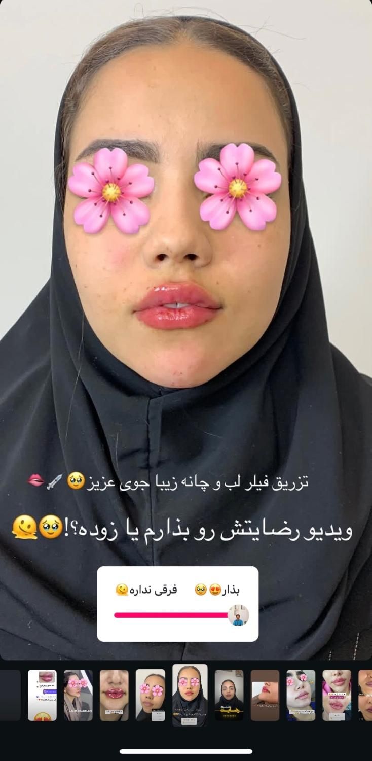 جشنواره خدمات زیبایی در کلینیک زیبایی توسط پزشک|خدمات آرایشگری و زیبایی|قم, زنبیل آباد|دیوار