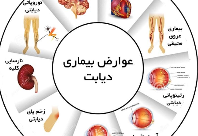 راهنمایی دیگه درمان شدن دیابت|فعالیت داوطلبانه|کرج, کیانمهر|دیوار