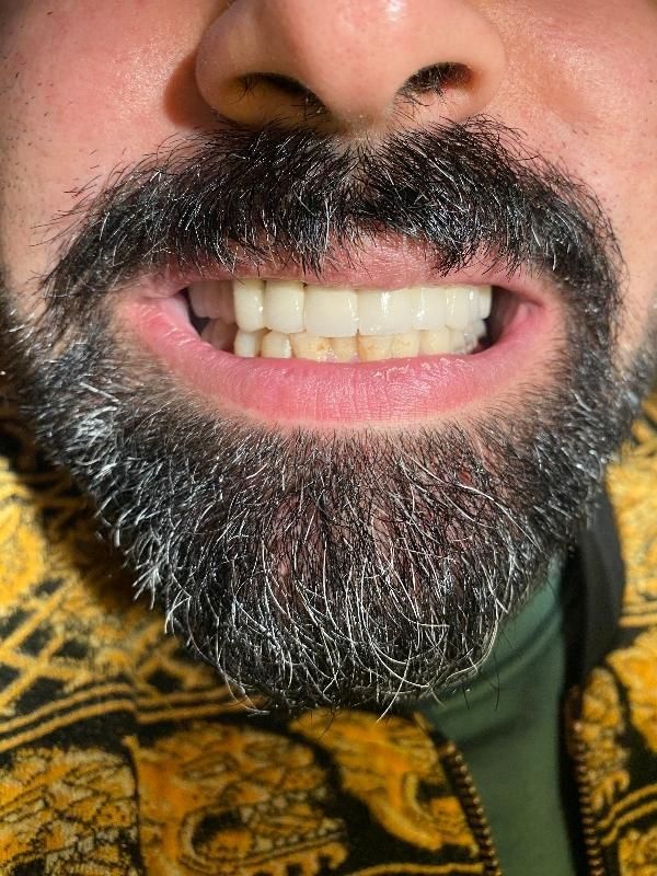 خدمات دندانسازی و دندانپزشکی|خدمات آرایشگری و زیبایی|ارومیه, |دیوار