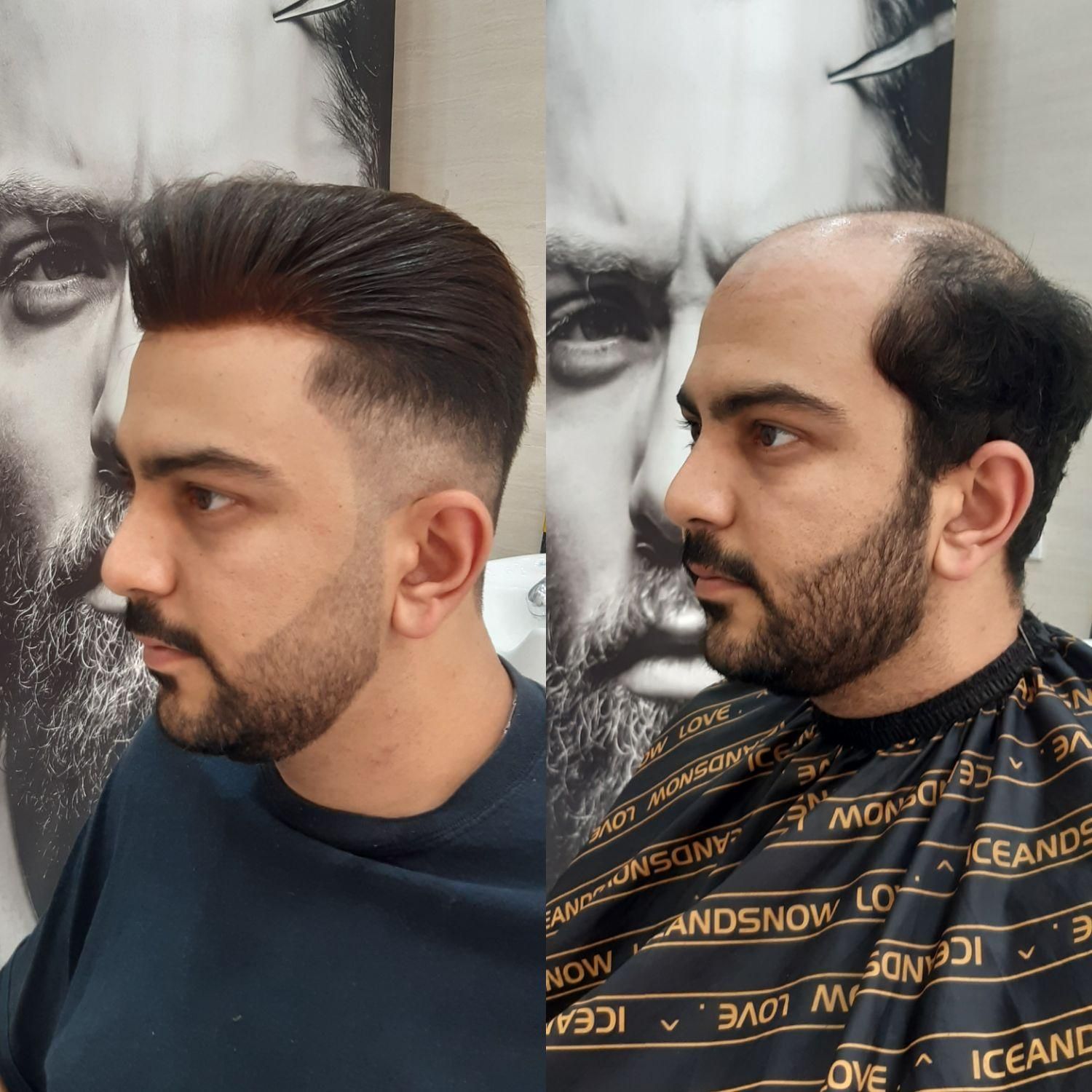 پروتز مو|خدمات آرایشگری و زیبایی|تهران, شهرک ولیعصر جنوبی|دیوار