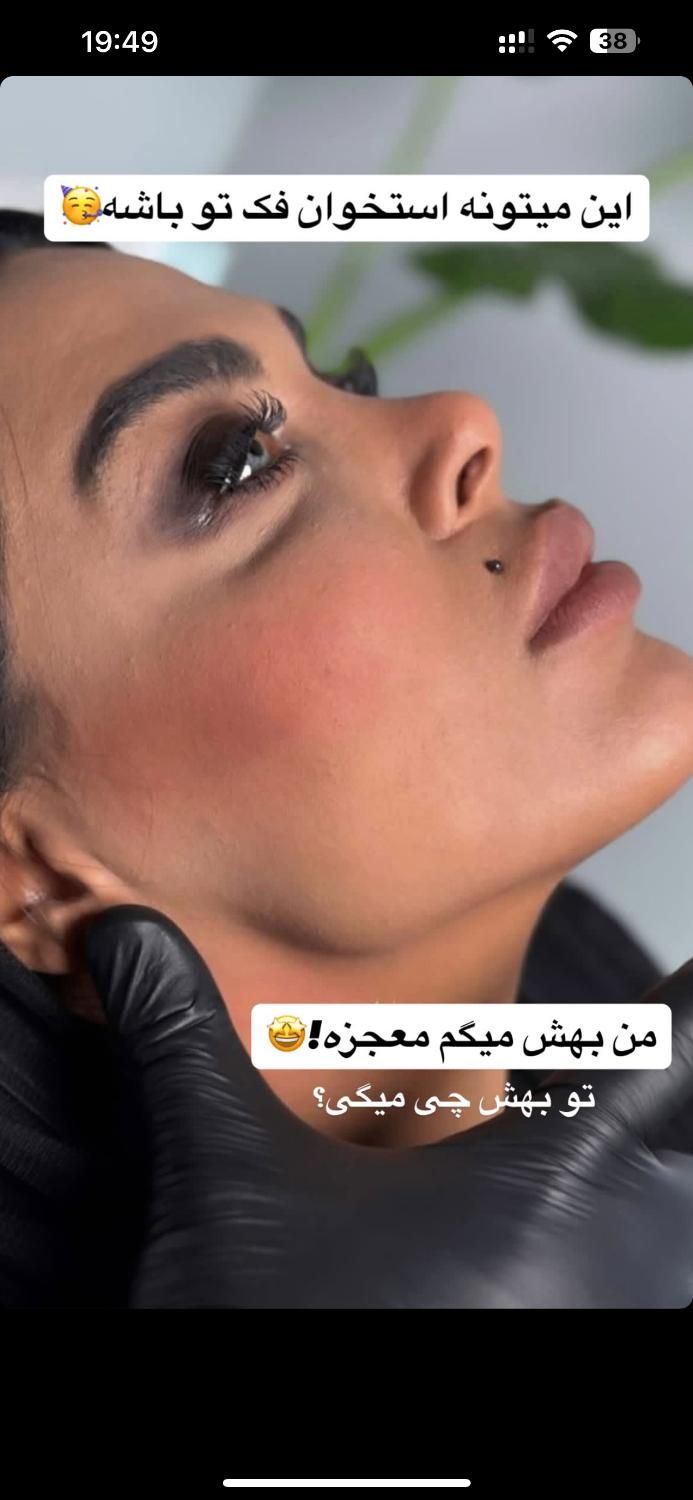 نیازمند مدل تزریق ژل و بوتاکس زیرنظر پزشک|خدمات آرایشگری و زیبایی|تهران, سعادت‌آباد|دیوار