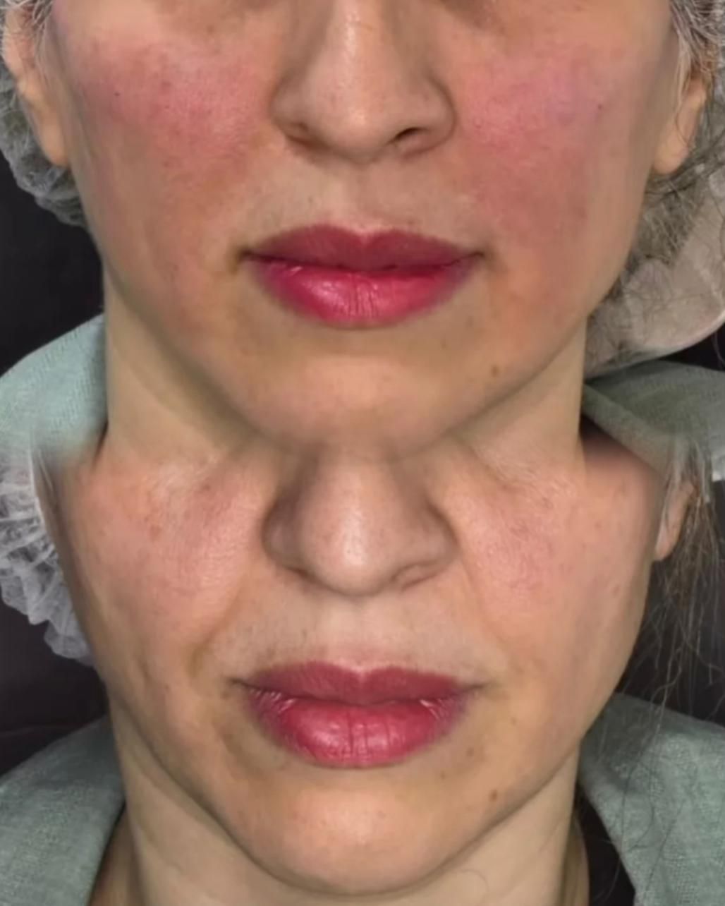 خدمات تخصصی پوست و مو در کلینیک فرسیما|خدمات آرایشگری و زیبایی|اسلام‌شهر, باغ فیض|دیوار