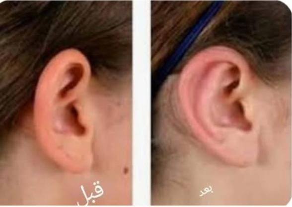 **جشنواره عمل زیبایی با قیمت‌های ویژه**|خدمات آرایشگری و زیبایی|شیراز, میرزاکوچک خان|دیوار