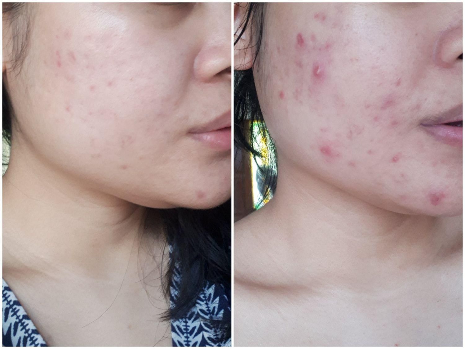 حجامت با لوازم کاملاً بهداشت و یکبار مصرف در مرکز|خدمات آرایشگری و زیبایی|کرمانشاه, |دیوار