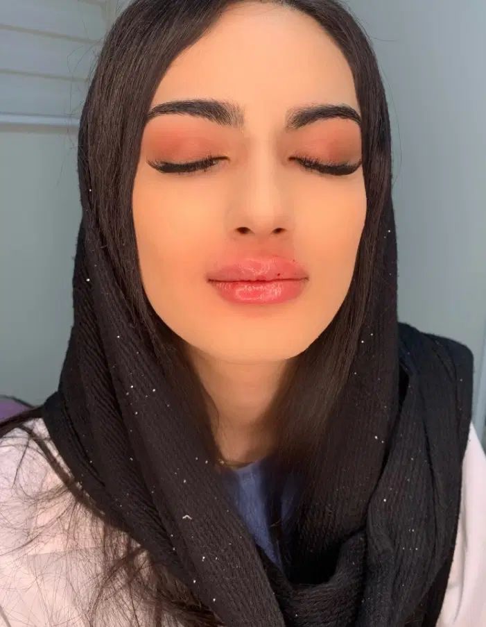 ژل لب روسی بوتاکس هیرفیلر کانتورینگ لیفت صورت|خدمات آرایشگری و زیبایی|تهران, پونک|دیوار