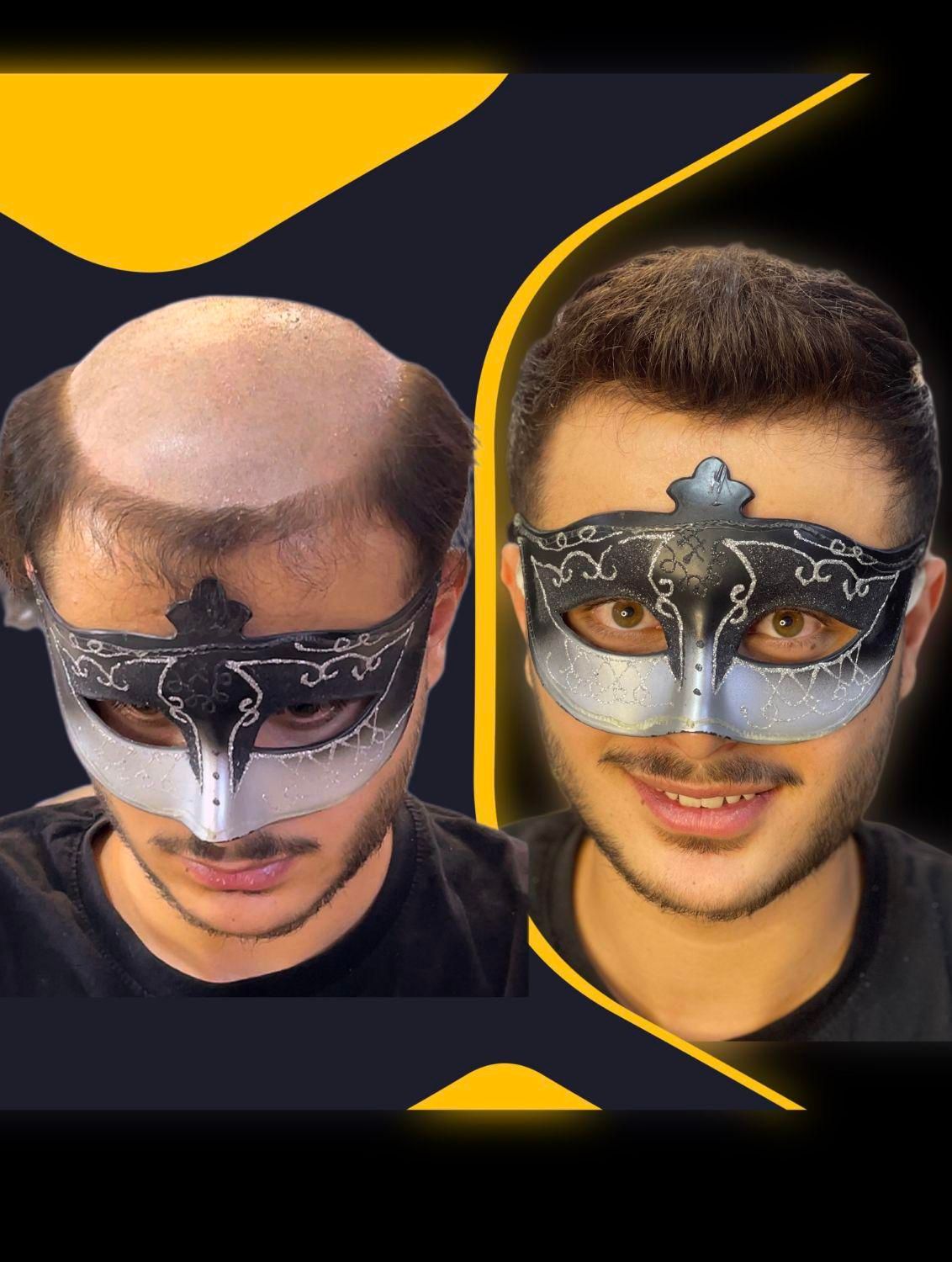 مرکز تخصصی پروتزمو /ترمیم مو در اصفهان|خدمات آرایشگری و زیبایی|اصفهان, خرم|دیوار