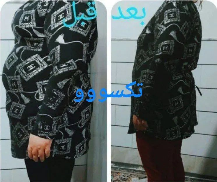 بمب لاغری کشف شد|آرایشی، بهداشتی، درمانی|مشهد, شهید معقول|دیوار