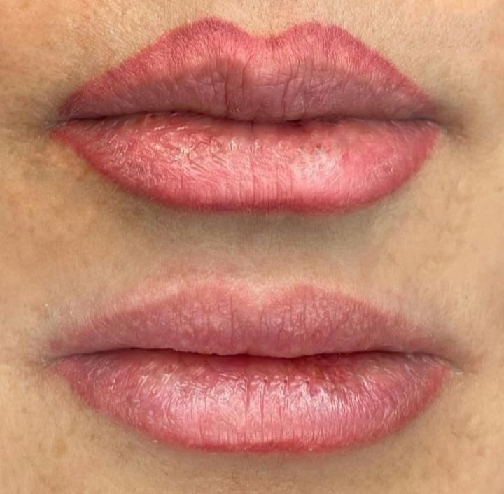 پاک کردن تتوهای قدیمی|خدمات آرایشگری و زیبایی|لنگرود, |دیوار