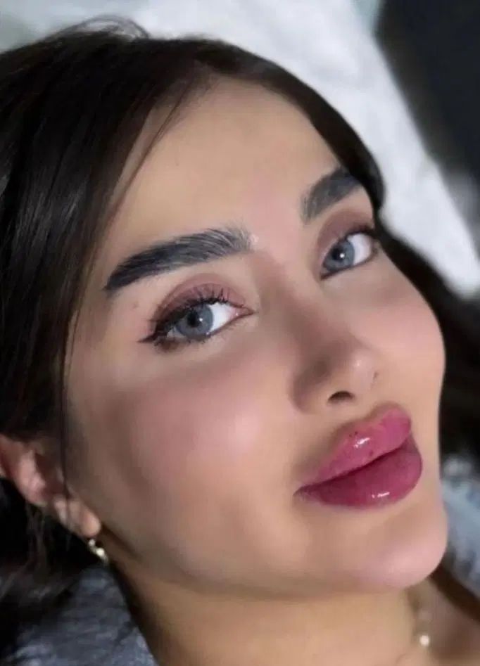 جشنواره تزریق ژل و بوتاکس در مطب با۴۰درصد تخفیف|خدمات آرایشگری و زیبایی|کرمانشاه, |دیوار
