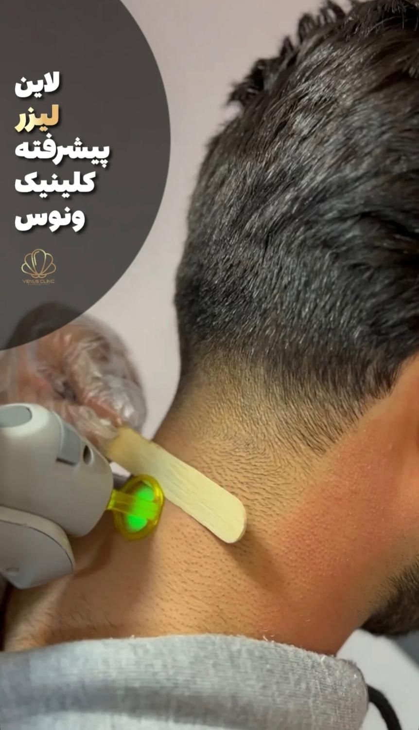 *جشنوااره خدمات تخصصی لیزر ، تزریق فیلر و بوتاکس|خدمات آرایشگری و زیبایی|اصفهان, هزارجریب|دیوار