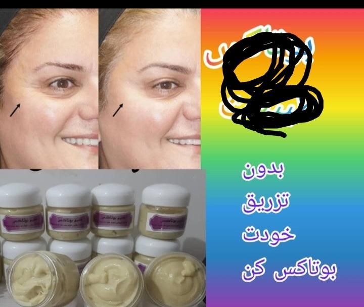 فروش همه نوع لوازم آرایشی درمانی چاقی لاغری ضدلک|آرایشی، بهداشتی، درمانی|دوگنبدان, |دیوار