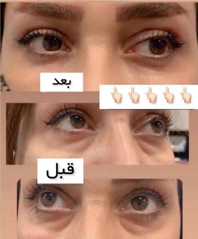 مشاوره تخصصی پوست ومو وپیشنهاد بهترین محصولات|آرایشی، بهداشتی، درمانی|مریوان, |دیوار