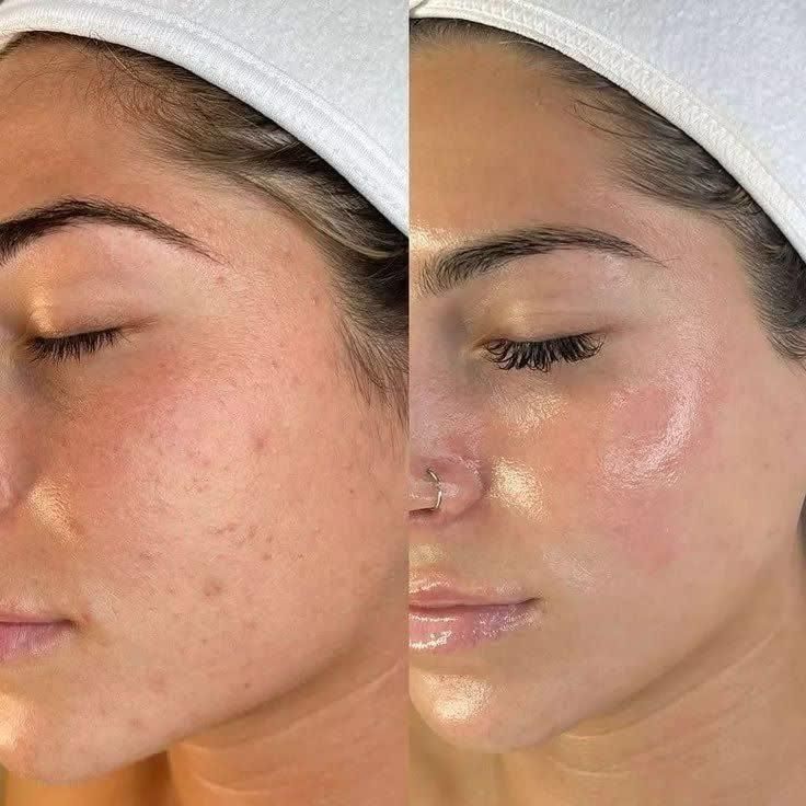 پاکسازی و فشیال صورت ویژه  بانوان و آقایان|خدمات آرایشگری و زیبایی|اردکان, |دیوار