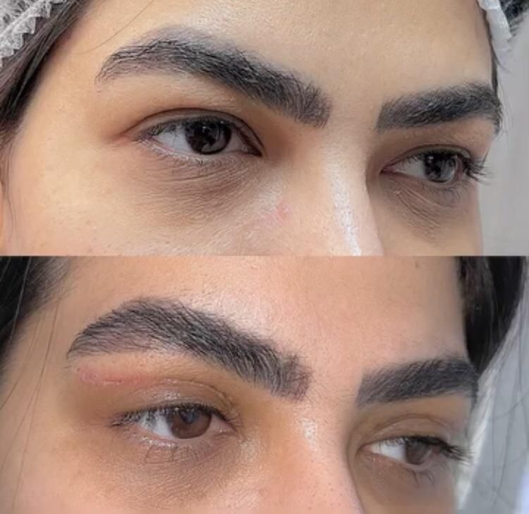 جراحی و زیبایی صورت و بدن، مزو، بوتاکس، چربی، فیلر|خدمات آرایشگری و زیبایی|کرمانشاه, |دیوار