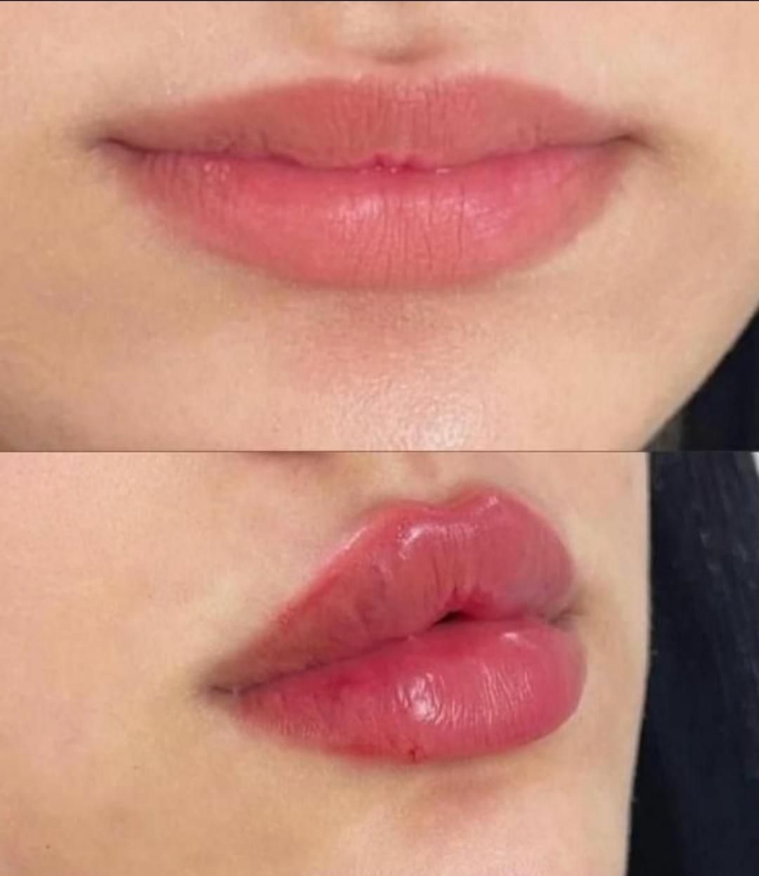 به چند نفر مدل تزریق ژل و بوتاکس نیازمندیم|خدمات آرایشگری و زیبایی|ارومیه, |دیوار