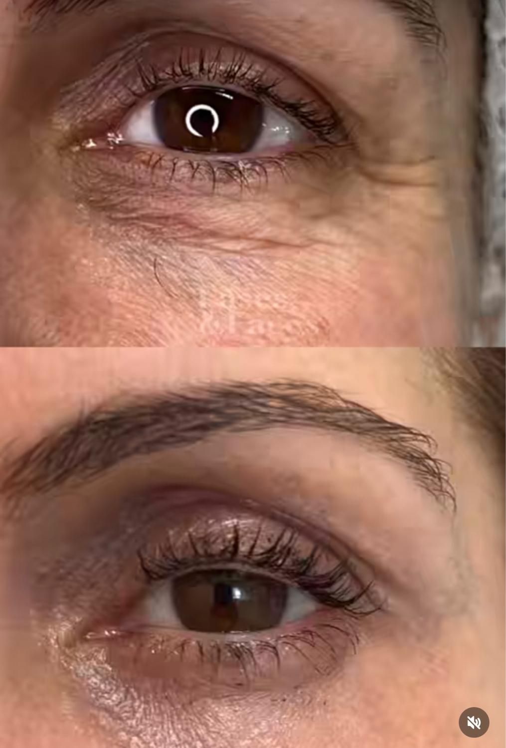 آموزش تخصصی فیشیال صورت و اسکراب اسکالپ حرفه ای|خدمات آموزشی|تهران, دریاچه شهدای خلیج فارس|دیوار
