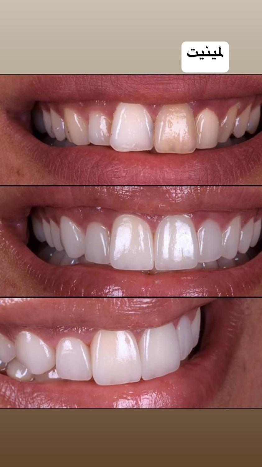 خدمات دندانپزشکی|خدمات آرایشگری و زیبایی|رشت, گلسار|دیوار