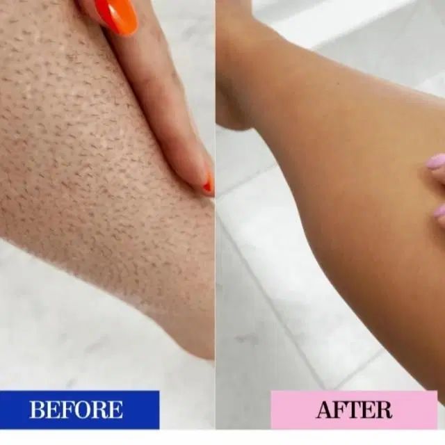 prp پی ارپی ژل فیلر بوتاکس نخ لیزر فیشیال هایفو|خدمات آرایشگری و زیبایی|مشهد, هفت تیر (حافظ)|دیوار
