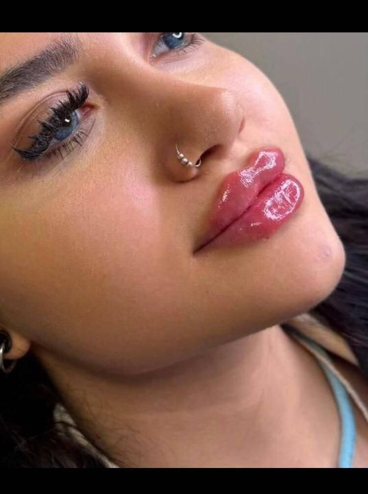 تزریق ژل فیلر مزوژل جوانساز بوتاکس لب روسی مزو مو|خدمات آرایشگری و زیبایی|کرج, گلشهر|دیوار