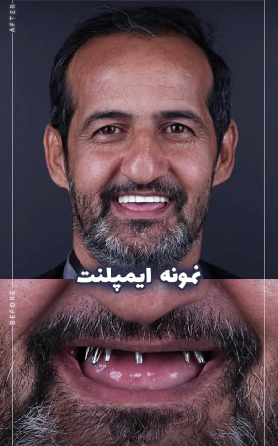 دندانپزشکی کامپوزیت لمینیت ایمپلنت بلیچینگ درمانی|خدمات آرایشگری و زیبایی|مشهد, سجاد شهر|دیوار