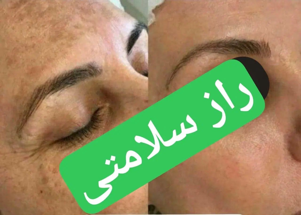 میخوای بدونی داخل بدنت چه مشکلی داره|خوردنی و آشامیدنی|مشهد, ارشاد|دیوار