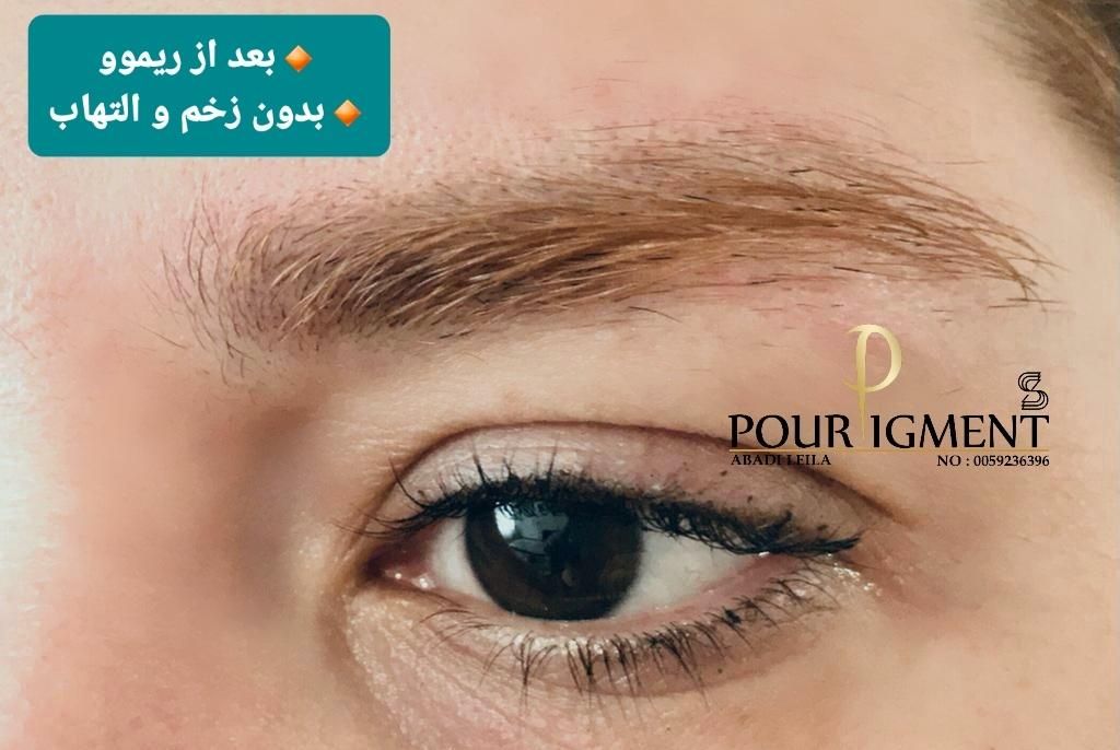ریموو ابرو چشم لب آنزیم تراپی نانوبروز مدل آموزش|خدمات آرایشگری و زیبایی|تهران, امیرآباد|دیوار